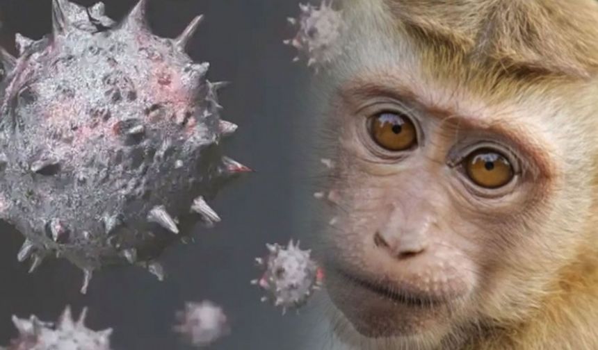 Eroğlu: "Maymun Çiçeği Virüsüne Karşı Bireysel Önlem Alınmalı"